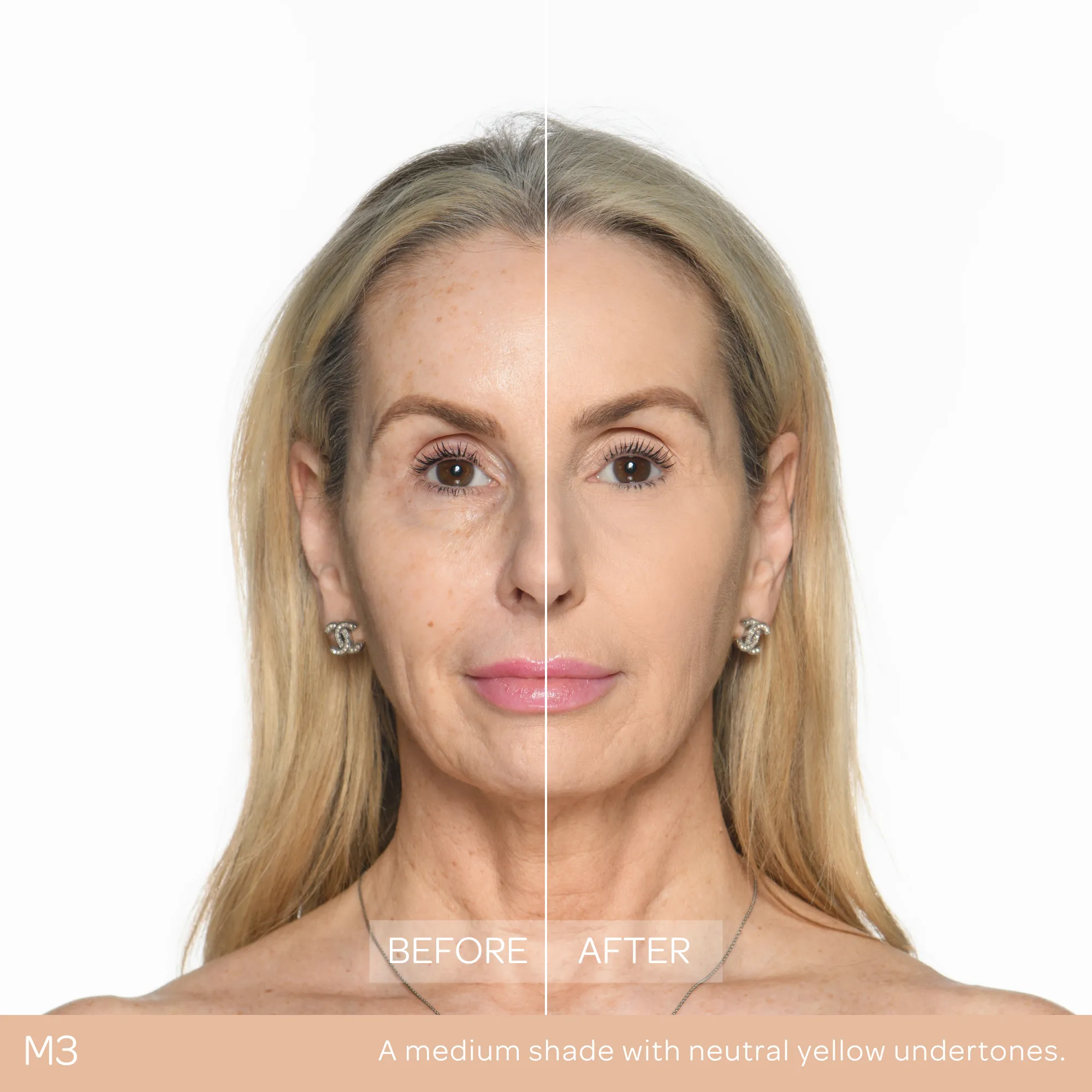 Conceal & Set Bundle - Image 27
