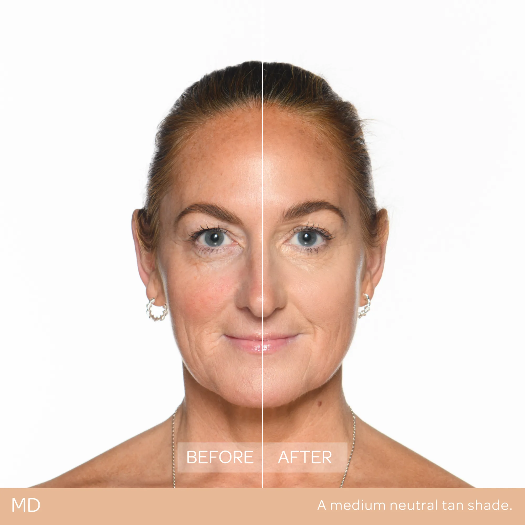 Conceal & Set Bundle - Image 36