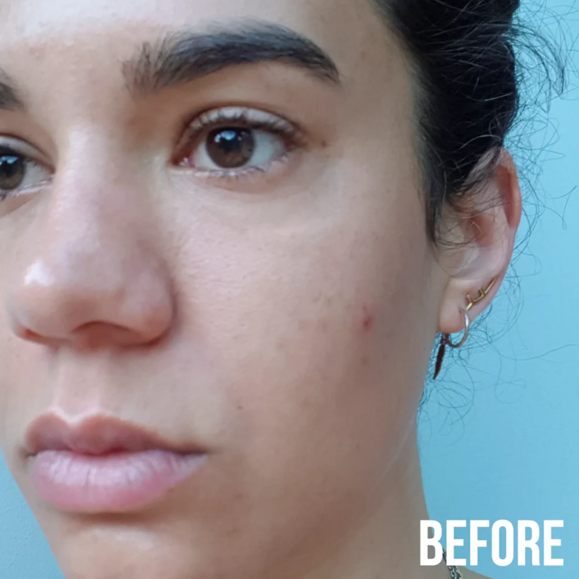 NIP+FAB - Hyaluronic Fix Extreme 4 Jelly Eye Patches - Image 4