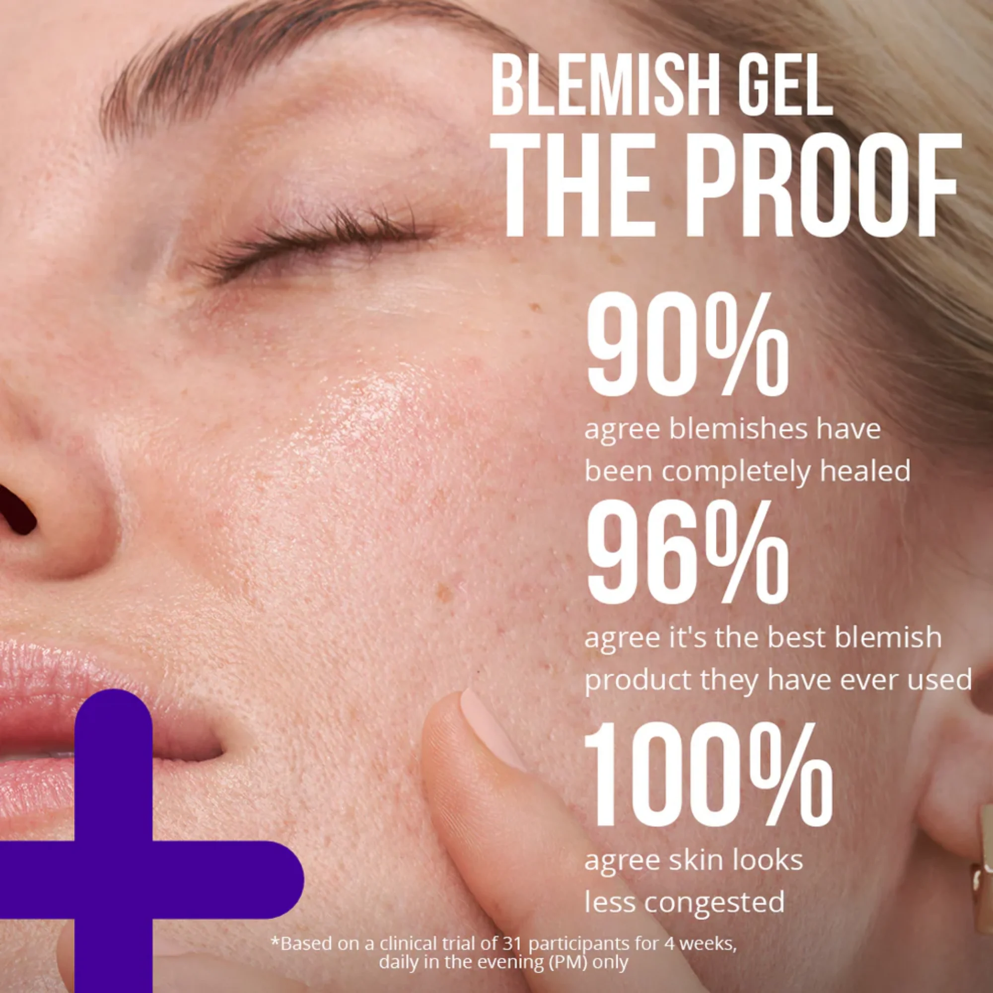 NIP+FAB - Retinol Fix Blemish Gel Treatment 10% - Image 3