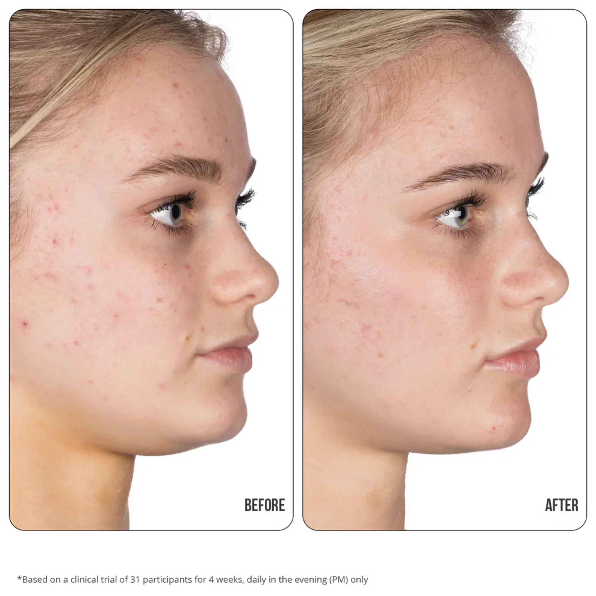 NIP+FAB - Retinol Fix Blemish Gel Treatment 10% - Image 4