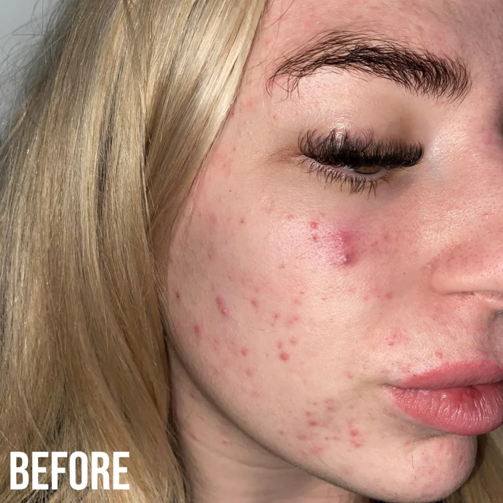 NIP+FAB - Retinol Fix Blemish Gel Treatment 10% - Image 5