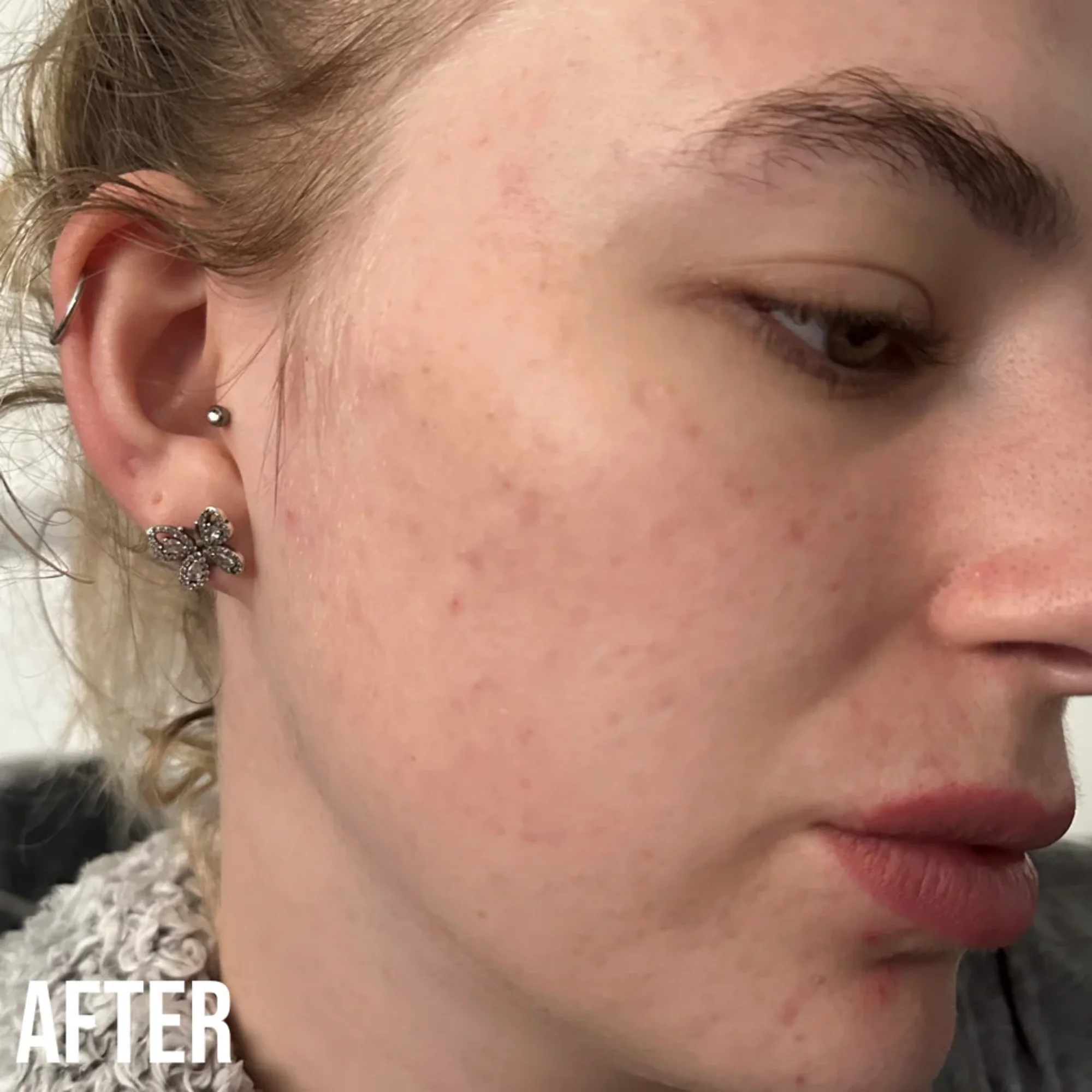 NIP+FAB - Retinol Fix Blemish Gel Treatment 10% - Image 6
