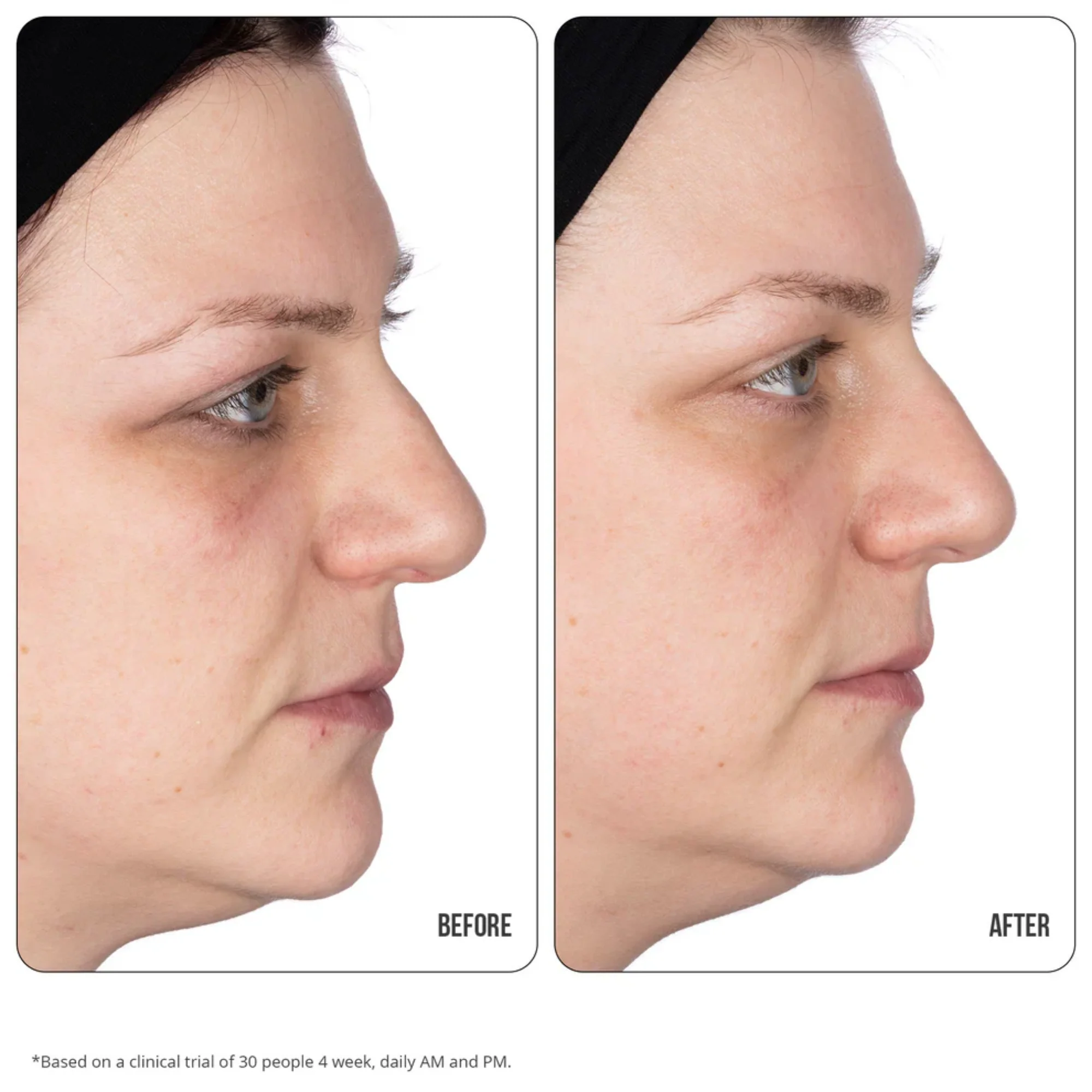 NIP+FAB - Vitamin C Fix Eye Cream 10% - Image 5