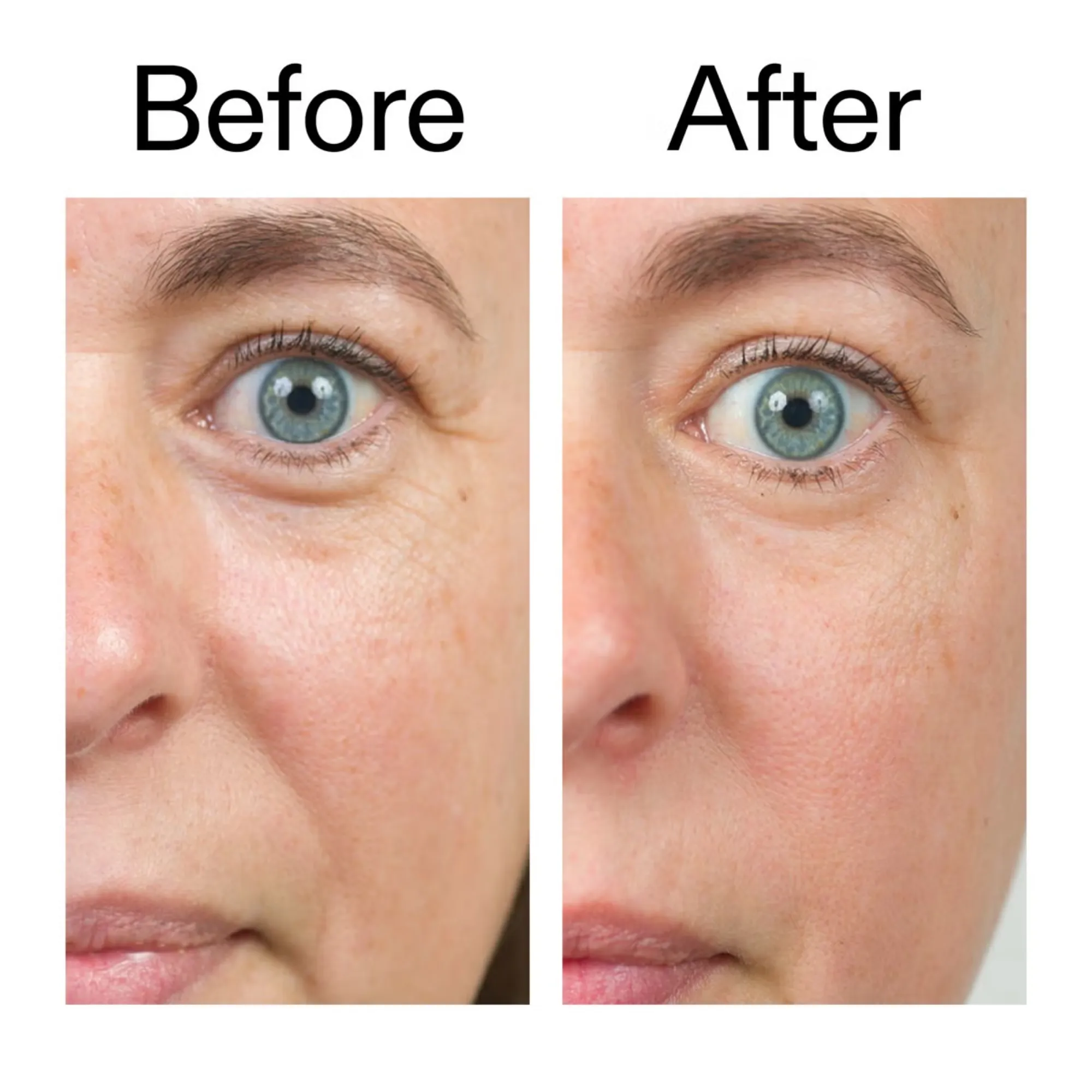 The Inkey List - Bio-active Ceramide - Image 2